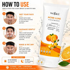 Acne Luxe Face Wash- Vitamin C, 2% Salicylic Acid & Niacinamide | Oil Control, Pimple Care, Deep Cleansing & Skin Brightening Formula