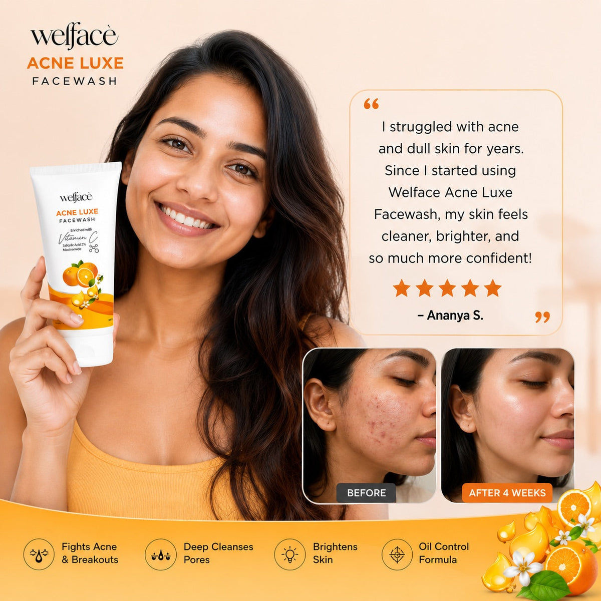 Acne Luxe Face Wash- Vitamin C, 2% Salicylic Acid & Niacinamide | Oil Control, Pimple Care, Deep Cleansing & Skin Brightening Formula